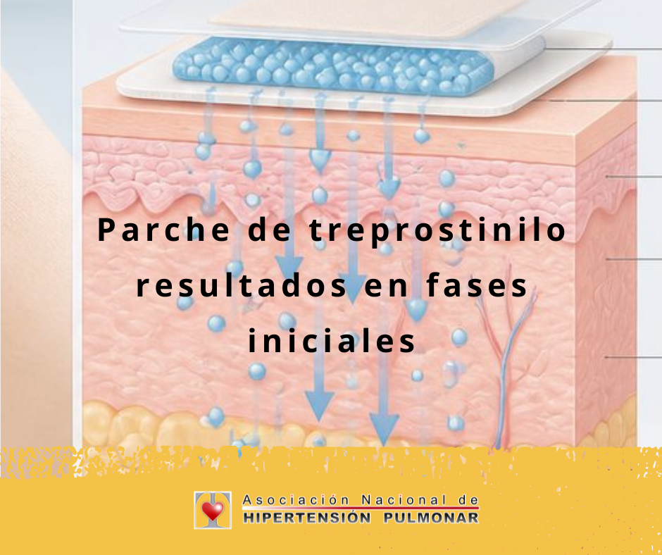 La investigación en hipertensión arterial pulmonar sigue avanzando: un parche de treprostinilo resultados en fases iniciales