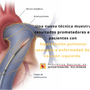 Una nueva técnica muestra resultados prometedores en pacientes con hipertensión pulmonar asociada a enfermedad del corazón izquierdo