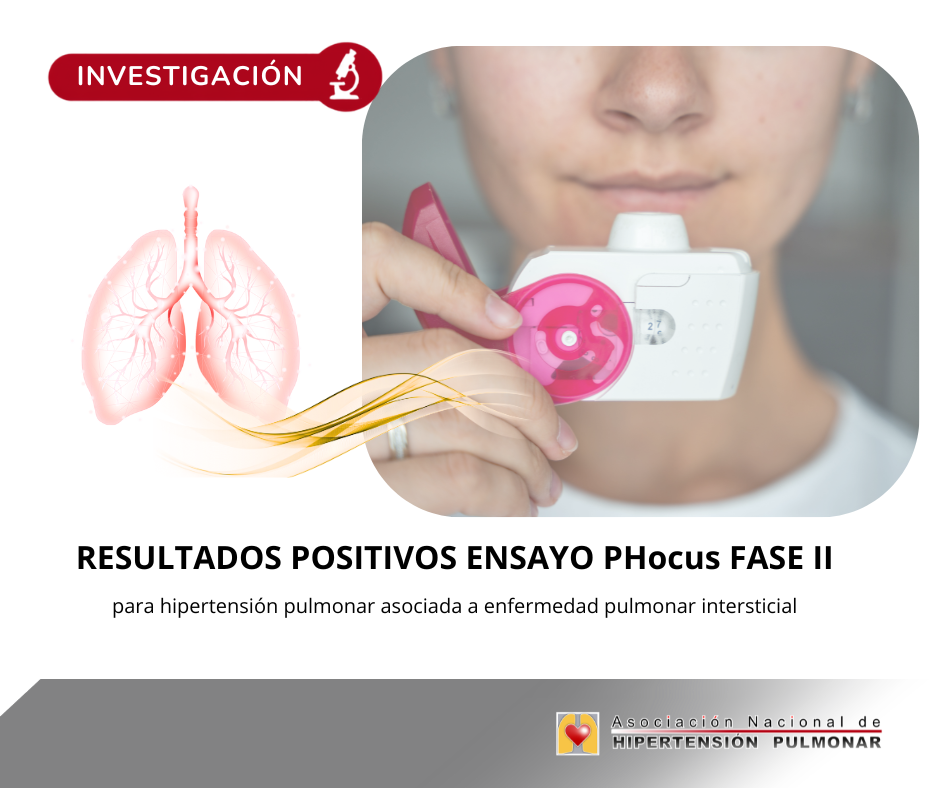 El ensayo PHocus muestra resultados positivos de mosliciguat en la hipertensión pulmonar asociada a enfermedad pulmonar intersticial